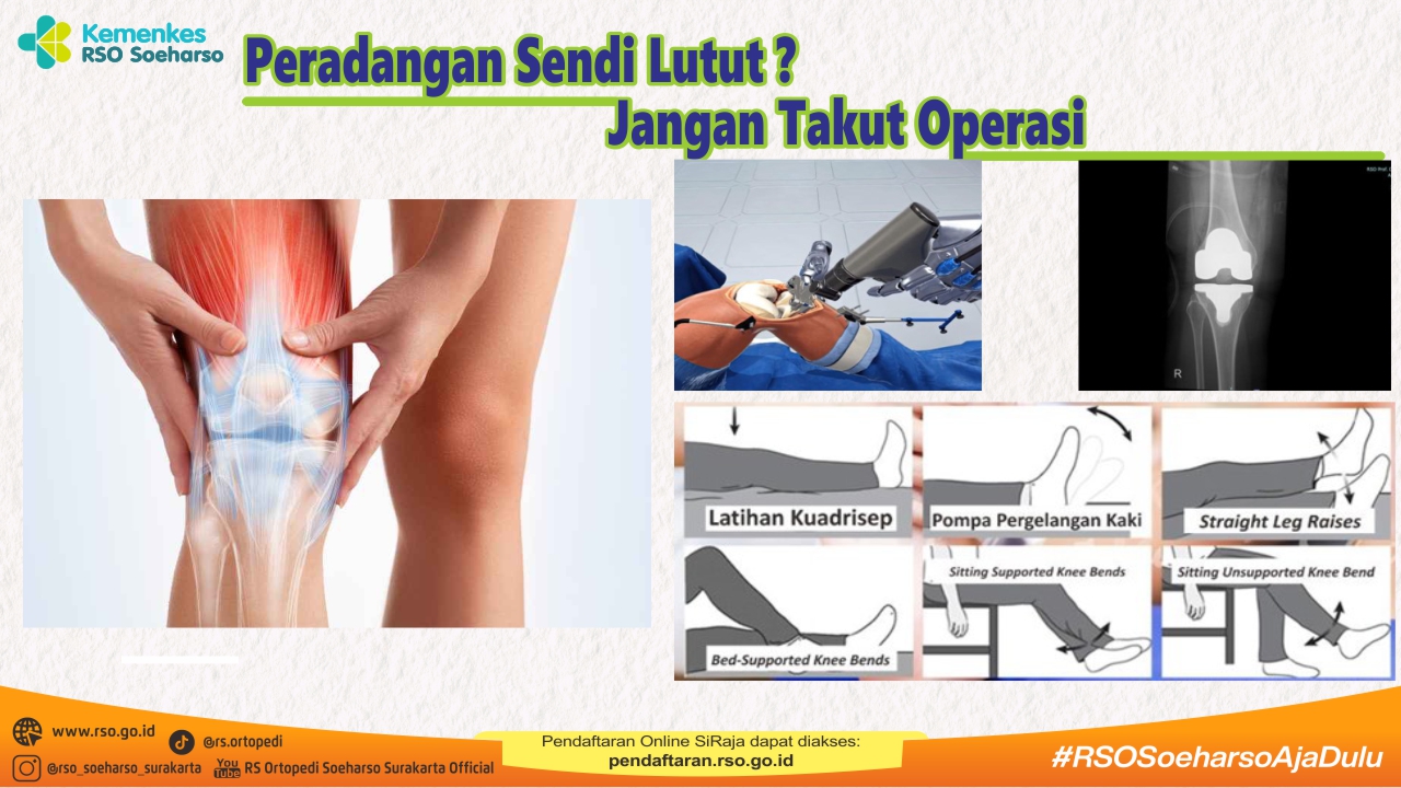 Kenali Penyebab Lutut Berbunyi dan Kapan Harus ke Dokter
