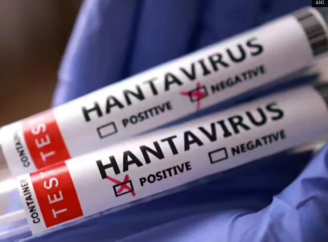 Kemenkes Pastikan Hantavirus Tak Akan Jadi Pandemi Seperti Covid-19
