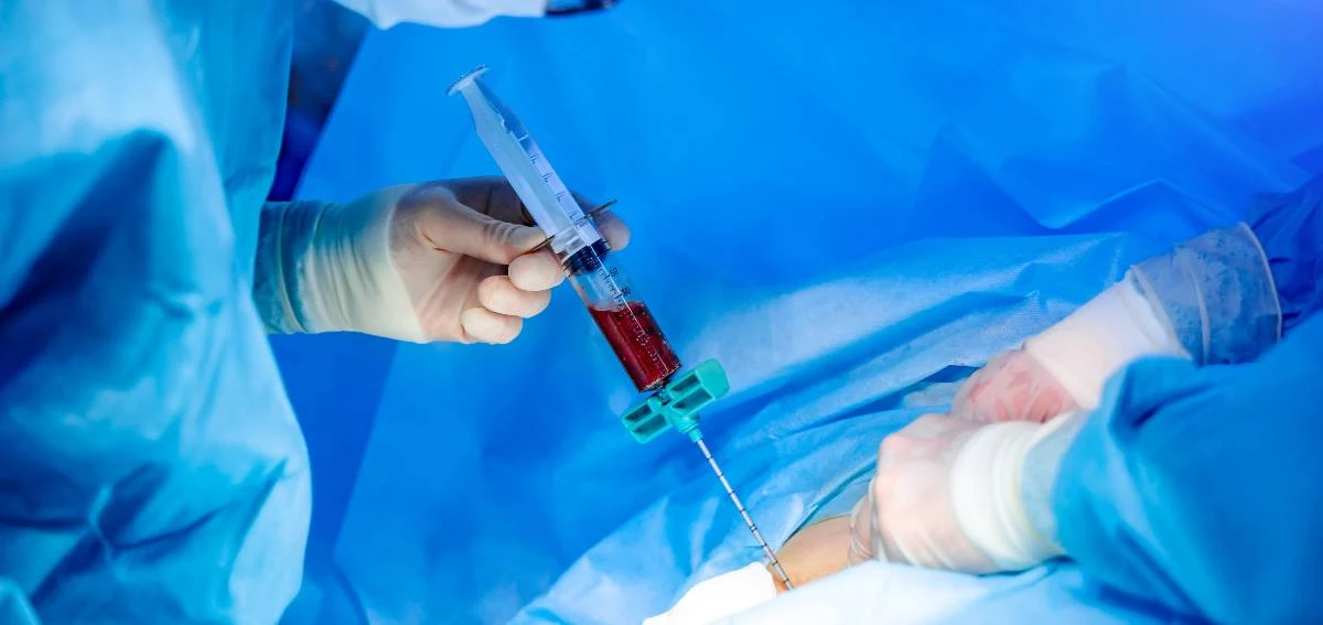 Menkes Budi Malu Indonesia Cuma Bisa 5 Transplantasi Sumsum Tulang Setahun