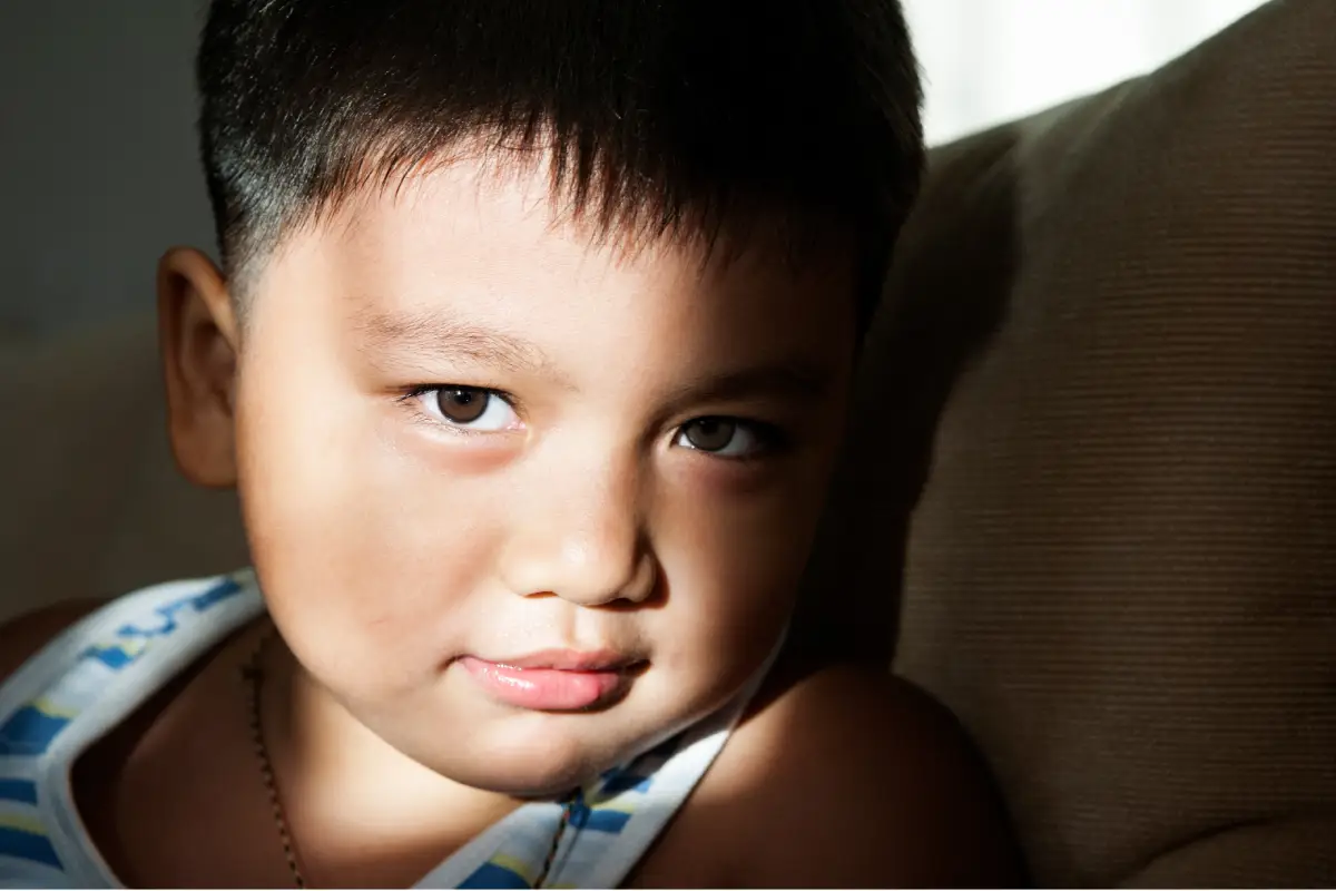 5 Fakta Obesitas pada Anak dan Strategi Pencegahannya
