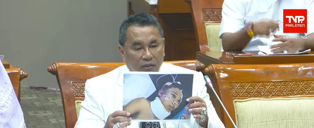 Kasus Pembunuhan Mahasiswi Unram Janggal, Hotman Pertanyakan Sosok Pembunuh Sebenarnya